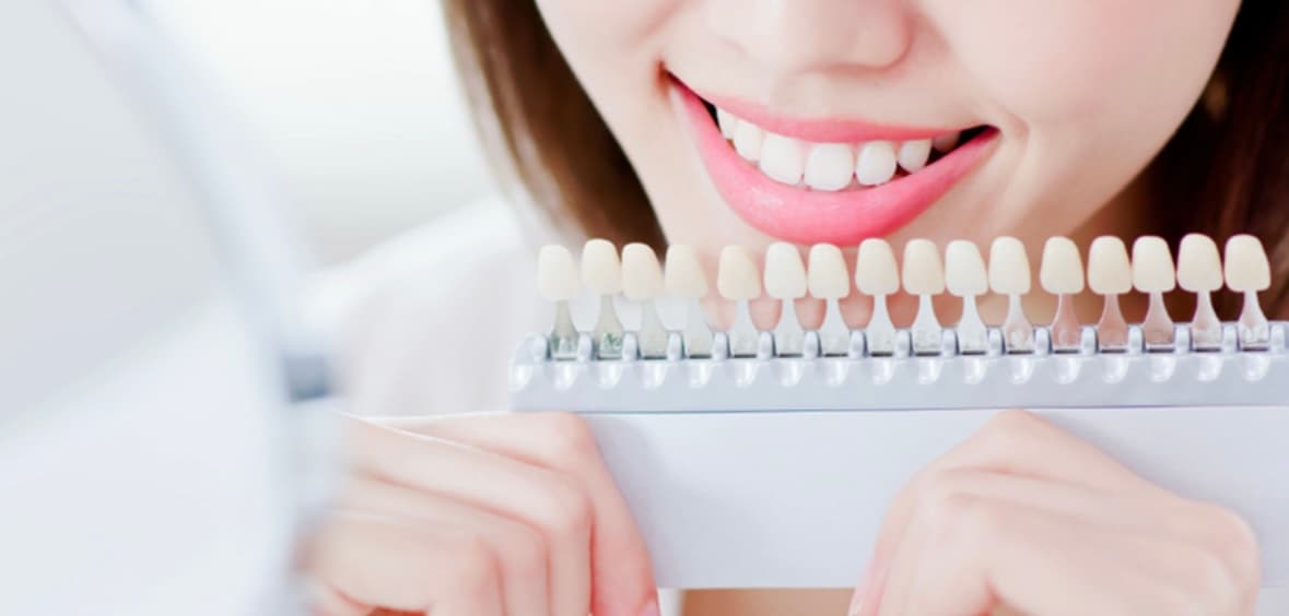 The thumbnail image of 春のホワイトニング新生活応援キャンペーン🌸