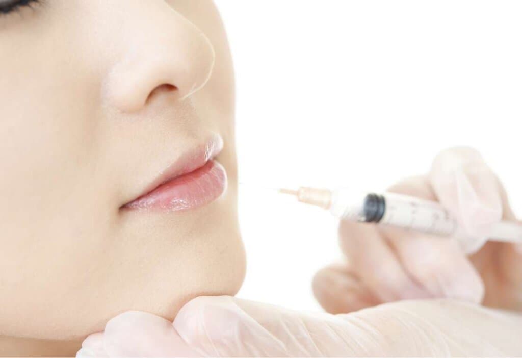 ボツリヌス治療